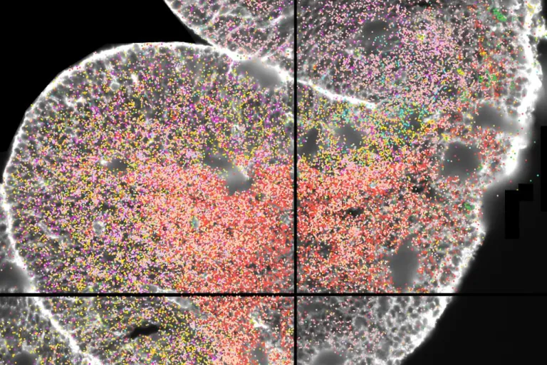 spatial transcriptomics