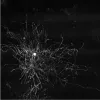 Lightsheet zoom
