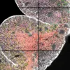 spatial transcriptomics